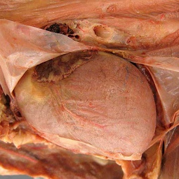 fascia of the heart